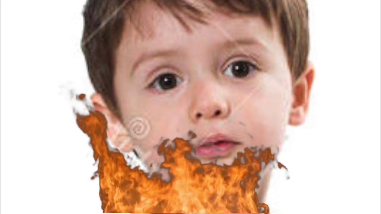 lactose intolerance