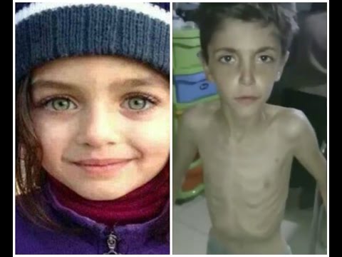 Madaya: What The Media isn't telling you