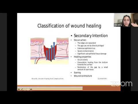 Wound healing, soft tissue regeneration & regional flap