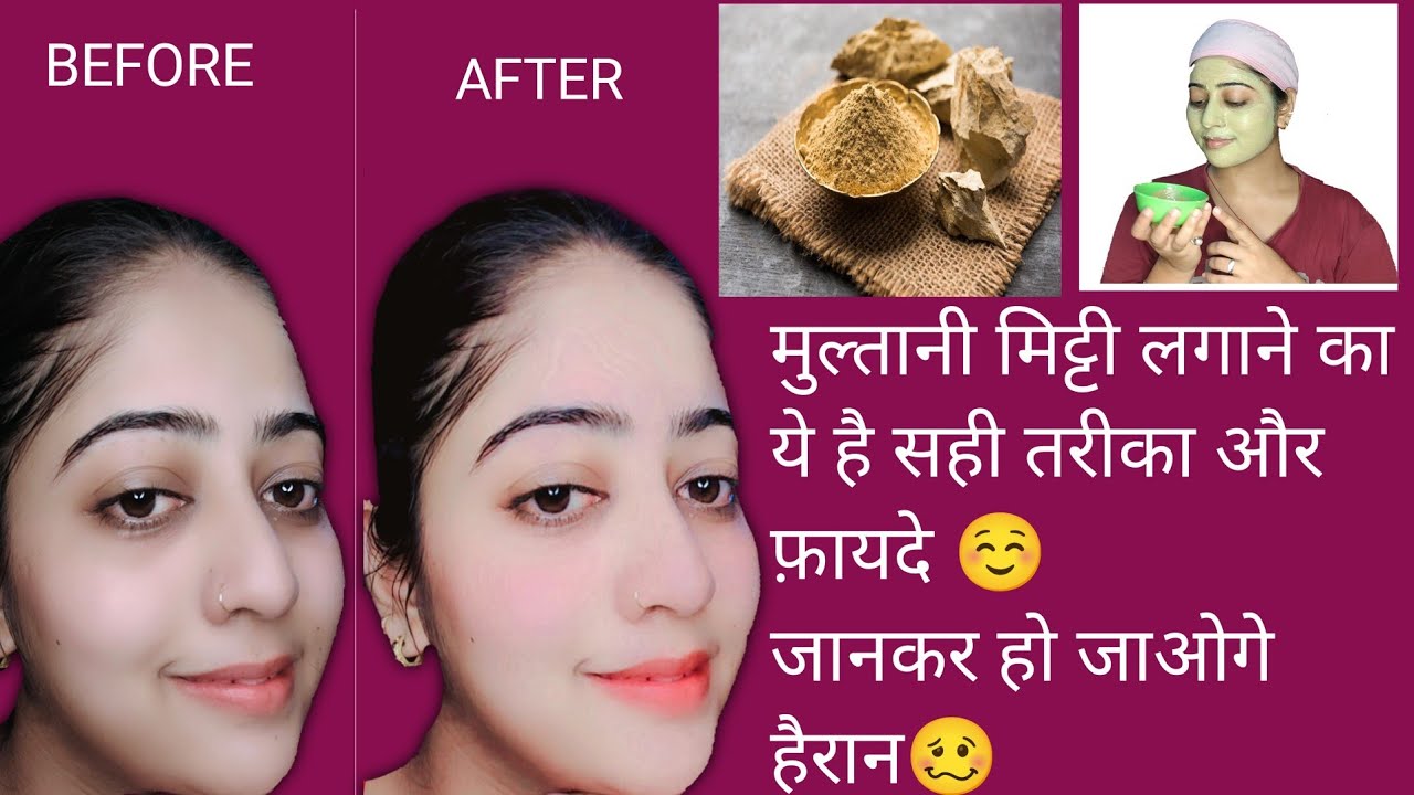 Multani mitti ke fayde Multani mitti face pack Multani mitti face