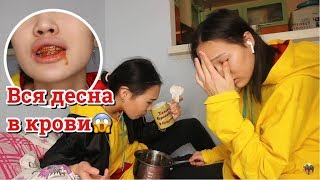 ПРАНК НАД СЕСТРОЙ: ДЕСНА ИСТЕКАЕТ КРОВЬЮ! // Kagiris Twins