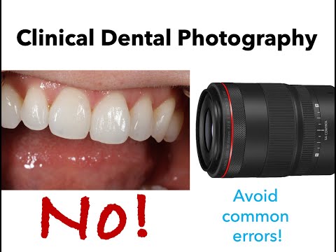 Dental Photography: 3 Tips for Excellent Anterior Images HD 1080p