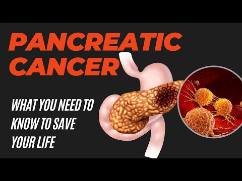 Pancreatic Cancer: The