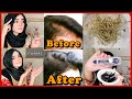 How To Grow Back Thinning Hairline Naturally | Stop Receding Hairline |100% Results | Dietitian Aqsa