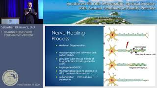 Regenerative Medicine as Neuropathy Treatment with Dr. Sebastian in Estero FL