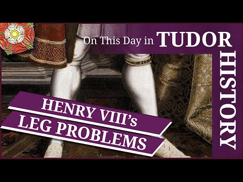 May 14 - Henry VIII's leg problems