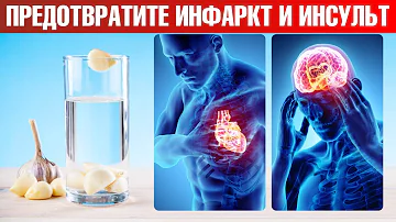 Пейте чесночную воду: профилактика инфаркта и инсульта🔥
