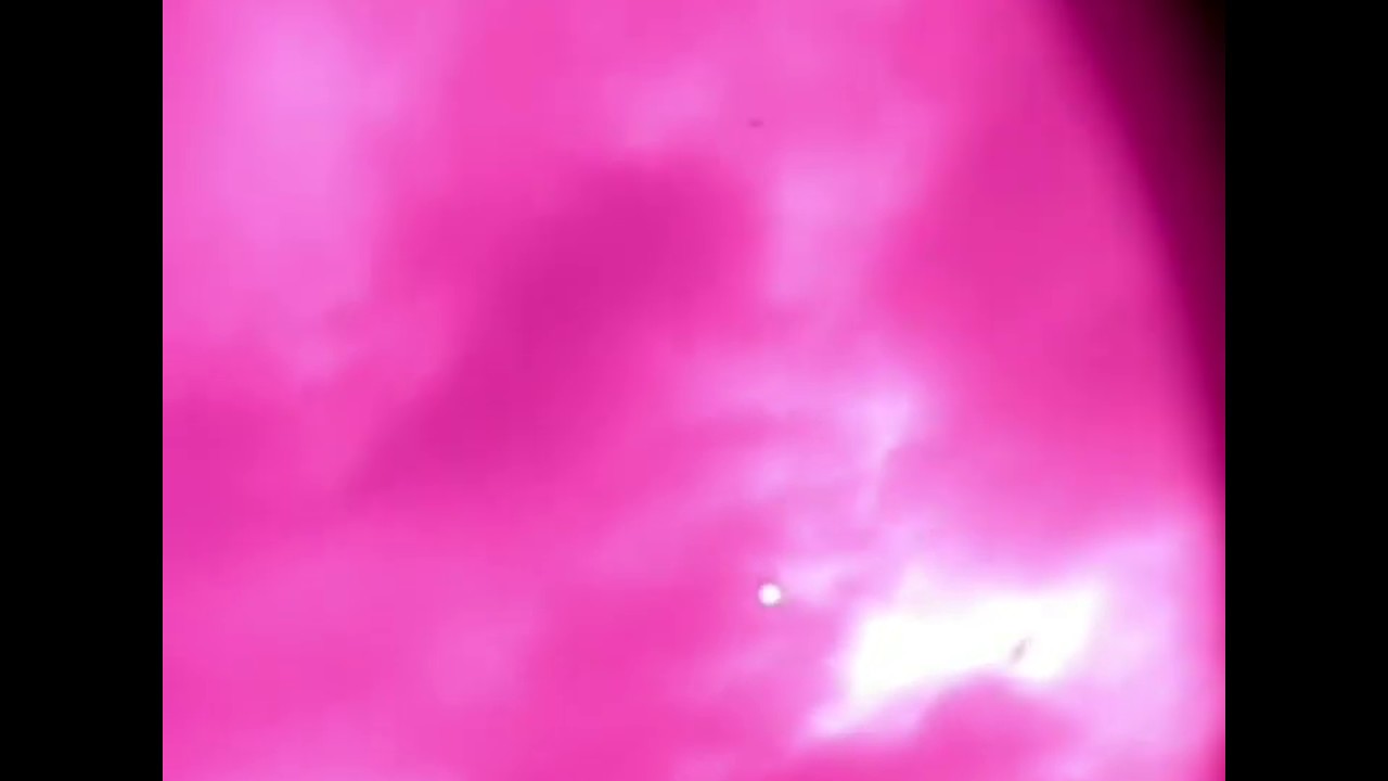 Anomalous object in IR