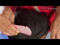 Natural Dandruff With Pink Combing!! Most Satisfying And Picking Dandruff Removal #280