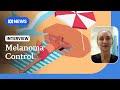 New data confirms melanoma treatment having life-saving impacts | ABC NEWS