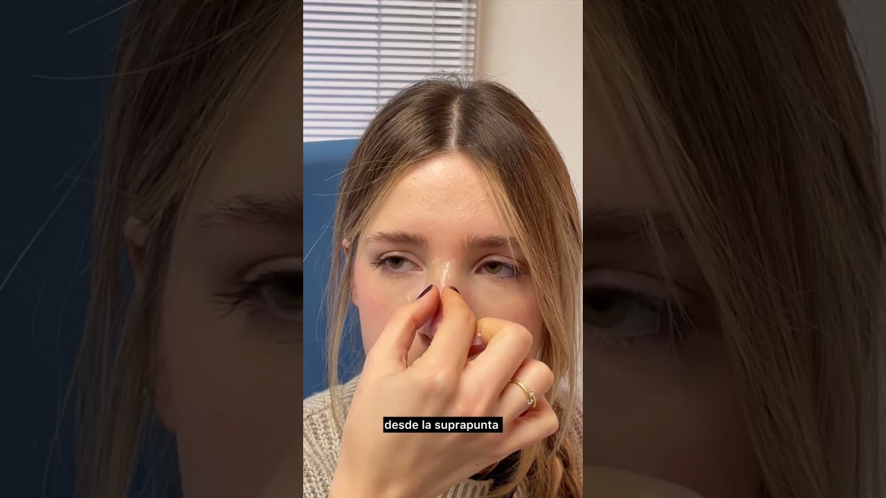 Drenaje linfático facial RINOPLASTÍA Postoperatorio