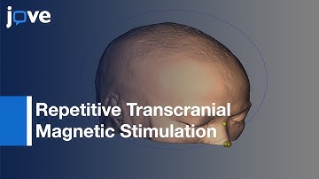 Neuronavigation-Guided Repetitive Transcranial Magnetic Stimulation For Aphasia l Protocol Preview