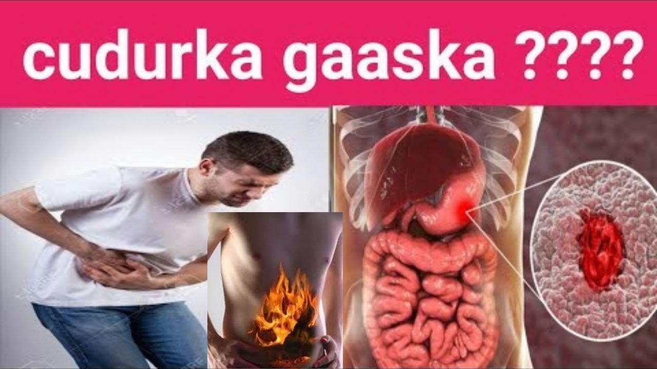 Dr Shiine: Si Fudud Isaga Dawee Gaaska Ogowna Waxa uu Ka Bilaawdo.