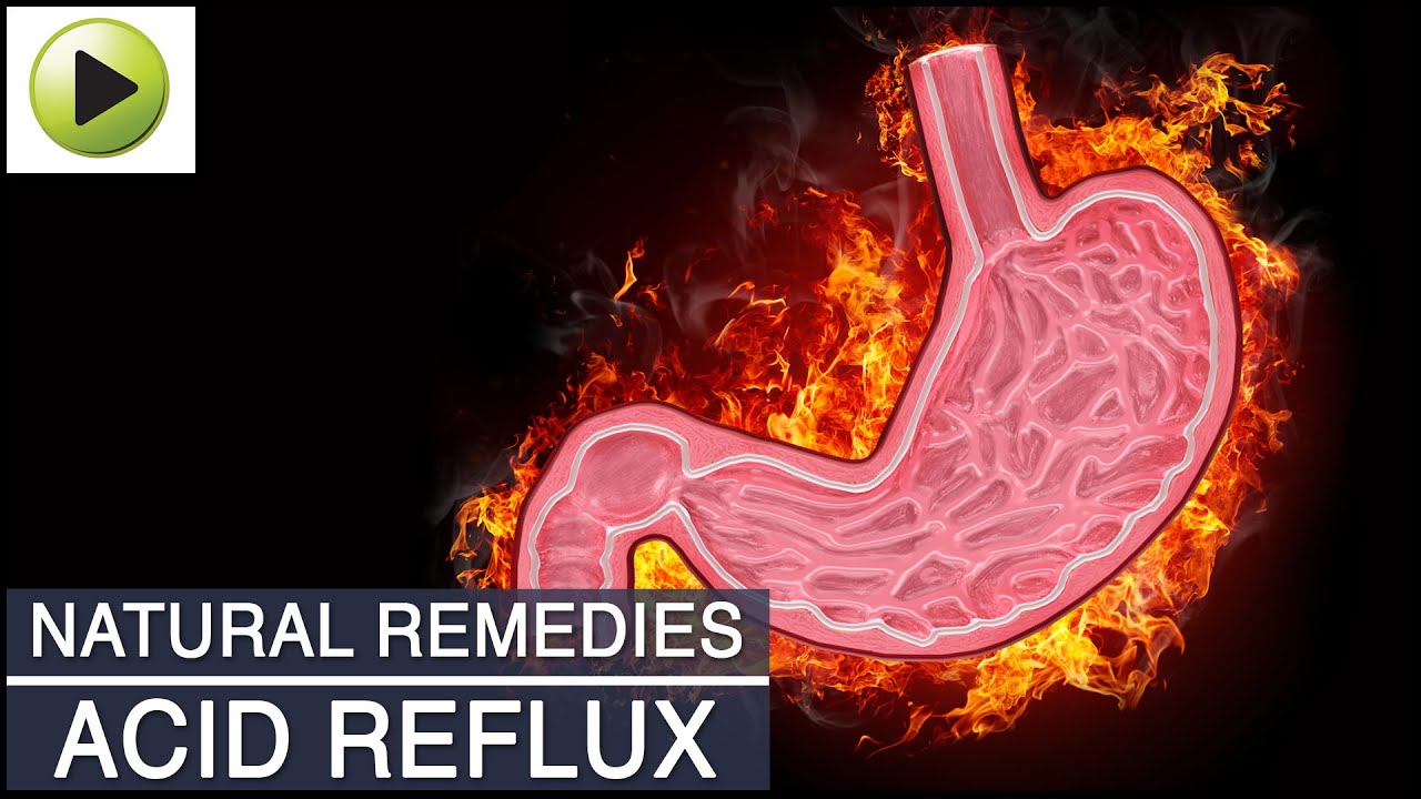 Acid Reflux (Acidity) - Natural Ayurvedic Home Remedies ...