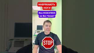 Чому Набряки ніг - НЕБЕЗПЕЧНІ?