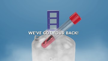 Accelerate Compound Screening with MultiScreen™ Assay-Ready Cells