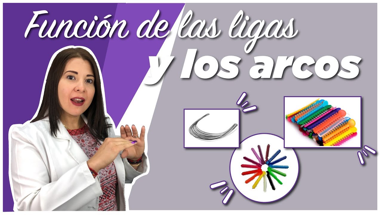 Cómo actúan las LIGAS Y LOS ARCOS sobre los BRACKETS!??