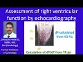 Assessment of right ventricular function by echocardiography