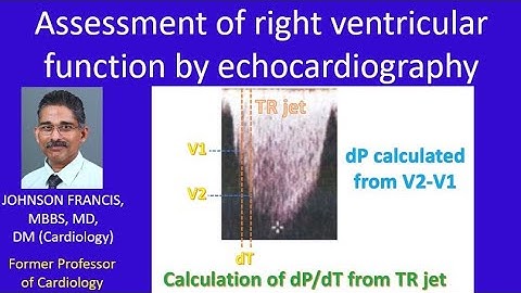 Assessment of right ventricular function by echocardiography