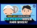 &quot;거품샴푸? 암흑기? 이게 대체 무슨 단어야?&quot; 비절개 모발이식 과정으로 자세히 알아보자!!