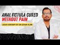 Anal Fistula Cured Without Pain | Laser Surgery by Dr Azhar Alam