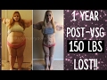 1 YEAR Post-Op VSG || 150 POUNDS LOST! || Full Body Pictures!