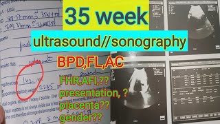 35 week(9 month)pregnancy ultrasound//sonography report reading