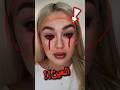 ما الذي يحدث لعين هذة الفتاة