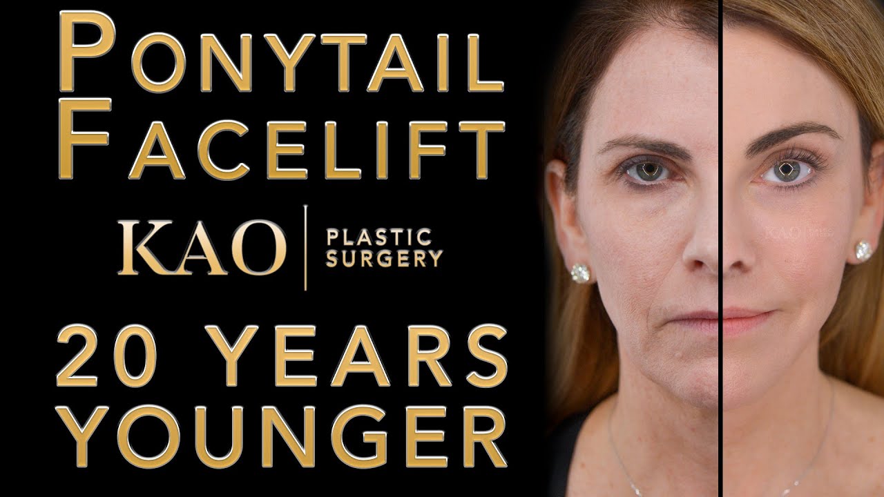 Extreme Makeover! Ponytail Facelift™ Progression KAO Plastic Surgery