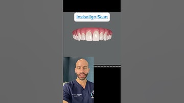 What’s an Invisalign Scan?