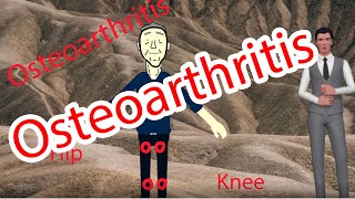 Osteoartritis - Pengobatan, tanda dan gejala, suplemen untuk Osteoartritis