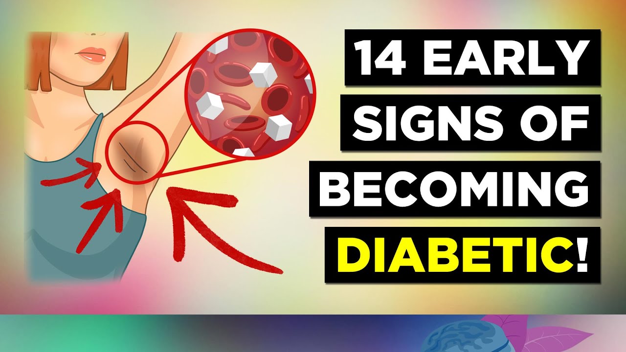14 Early Signs of Diabetes (Prediabetes) Tổng quát các kiến thức liên