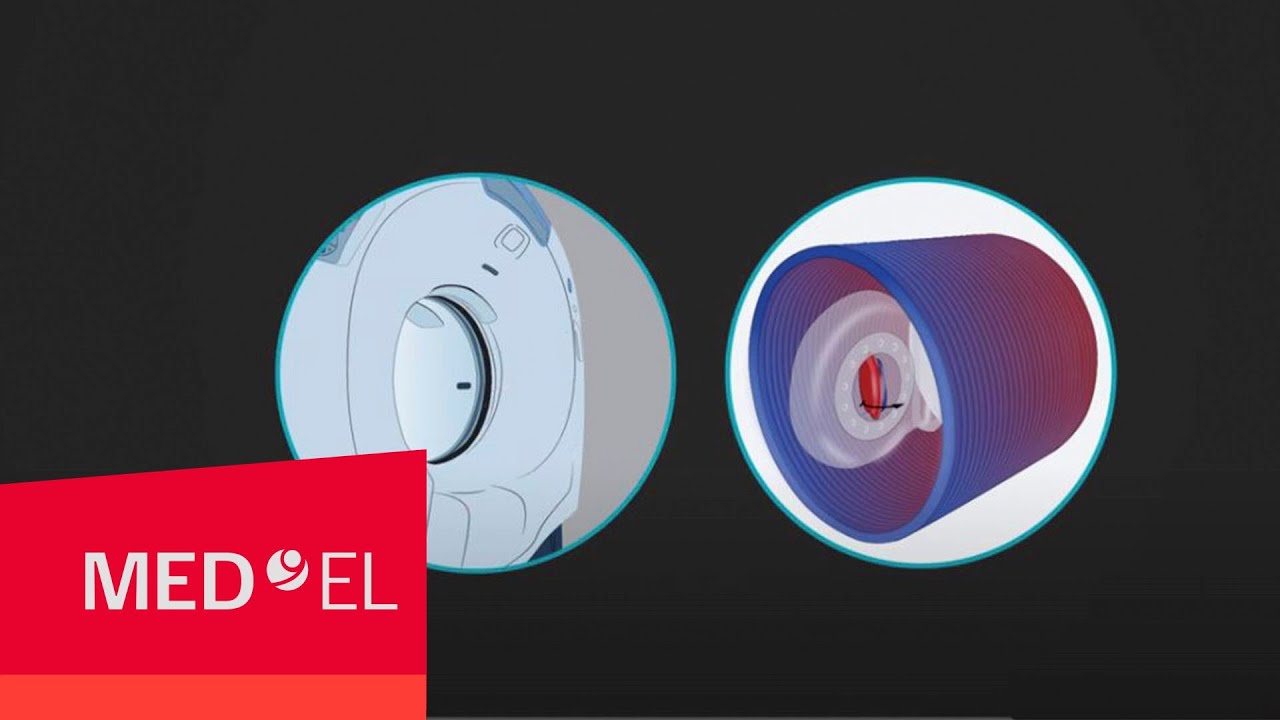 أهمية السلامة أثناء التصوير بالرنين المغناطيسي لزارعي القوقعة | ميدال