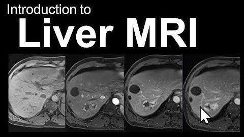 Dynamic Liver MRI | Special Sequences of Liver MRI | #Liver #dynamic #MRI #1.5T