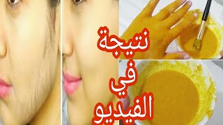 مهم لكل من يريد التخلص من الشعر الزائد وإزالة الشعر الزائد نهائياً وكل من يعاني من زيادة شعرالجسم