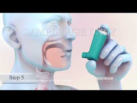 Video: Surgam - Instructions For Use, Indications, Doses