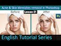 Healing Brush tool and Spot Healing Brush tool in Photoshop (Lesson 21)