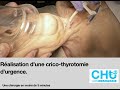 Cricothyrotomie durgence