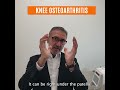 Arthrithis of Knee, Causes, and Non Surgical Advanced Treatments | Dr. Arkam Rehman
