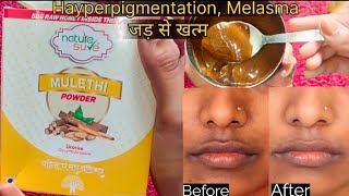 Hayperpigmentation, dark spots remove remedy। benifits of mulethi। Nature sure mulethi Powder review