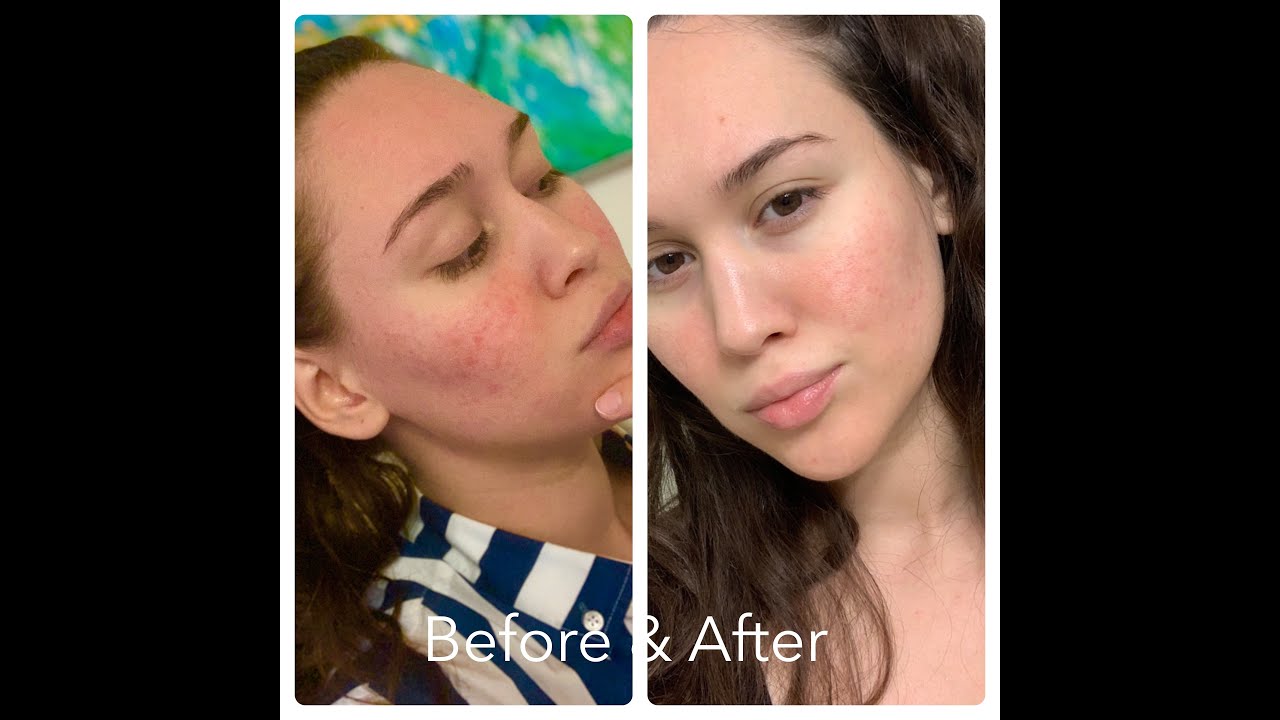 Skin Care Journey using TATCHA! YouTube