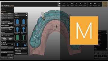 Bars module of Zirkonzahn.Modellier | Zirkonzahn.Software