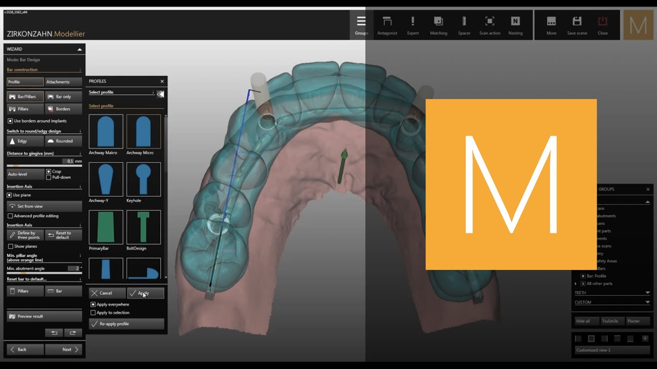 Bars module of Zirkonzahn.Modellier | Zirkonzahn.Software