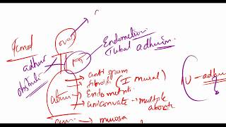 Infertility - OBG (Concept clearing - 1)