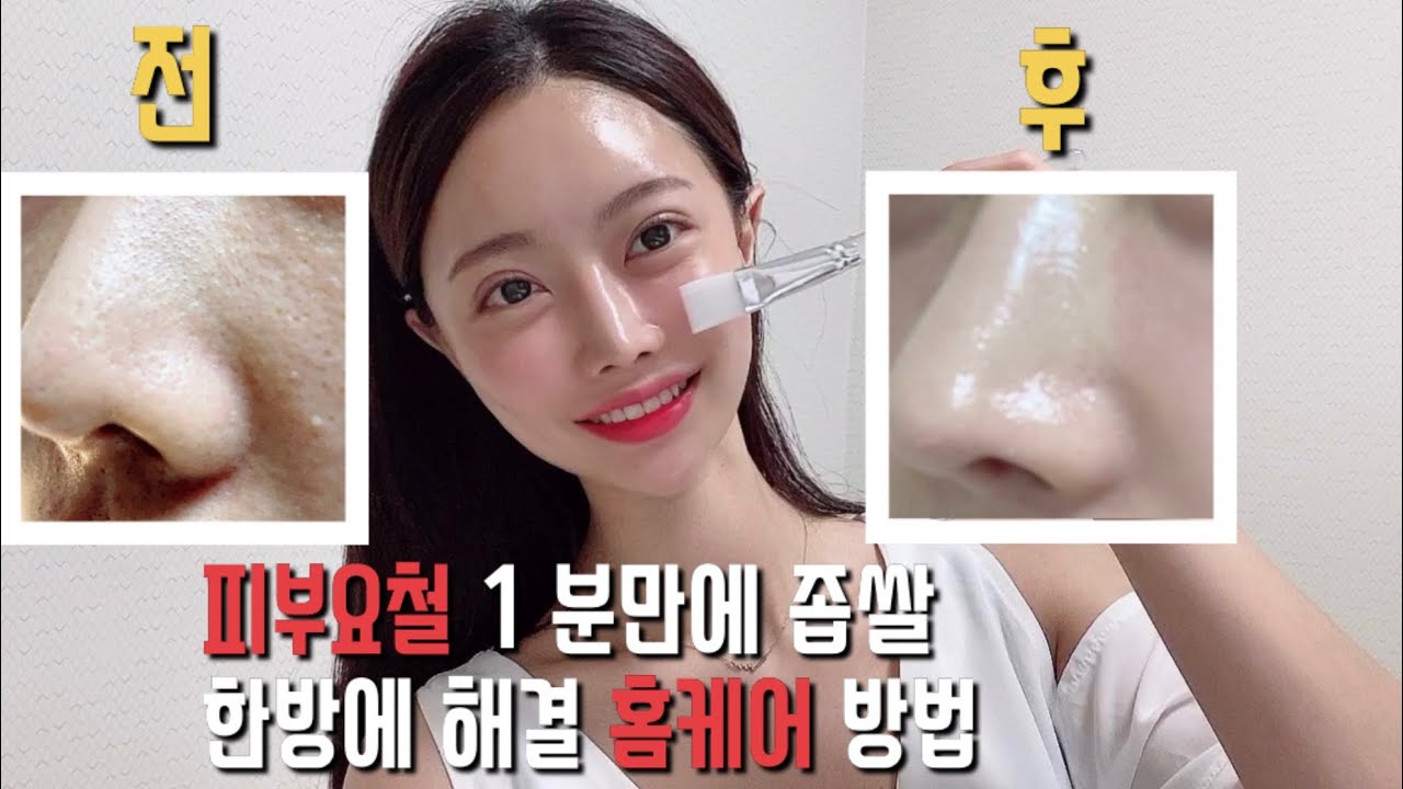 피부요철&좁쌀관리(오돌토톨 코옆)완벽하게 사라지는 홈케어 필링&각질관리 공개👍🏻피부과관리법 그대로 필링각질홈케어 하는 방법 ...