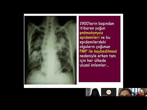 Video: Akciğerleri Doğal Olarak Detoks Etmenin 5 Yolu