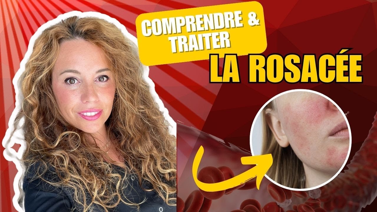 Rosacée des solutions existent (et elles fonctionnent vraiment) YouTube — free download