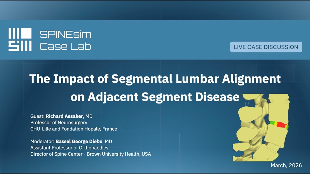 Segment Alignment SPINEsim Case Lab Webinar - The Impact of Segmental Lumbar Alignment on ...
