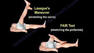 Piriformis Test, piriformis syndrome