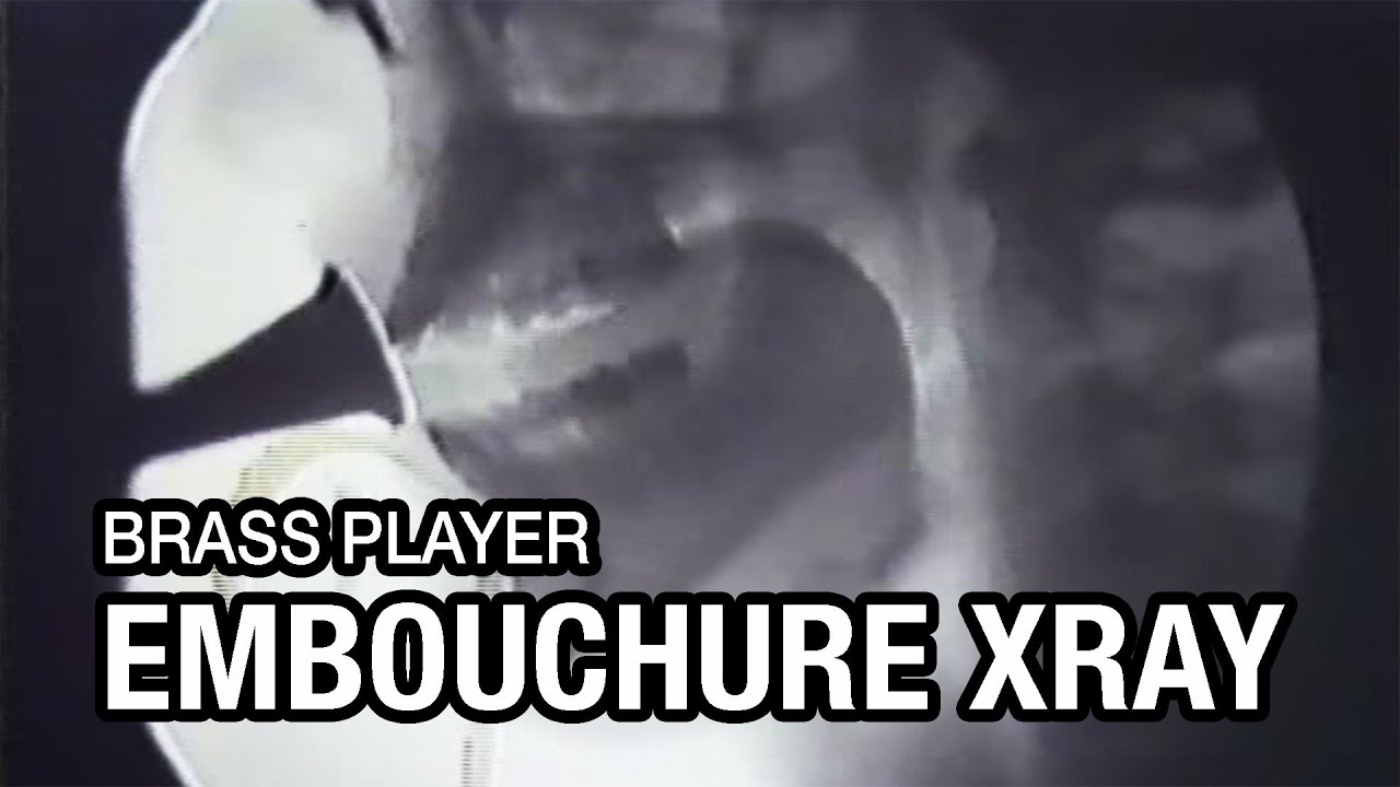 Joseph Meidt XRAY-Movies of Trumpet and Horn player